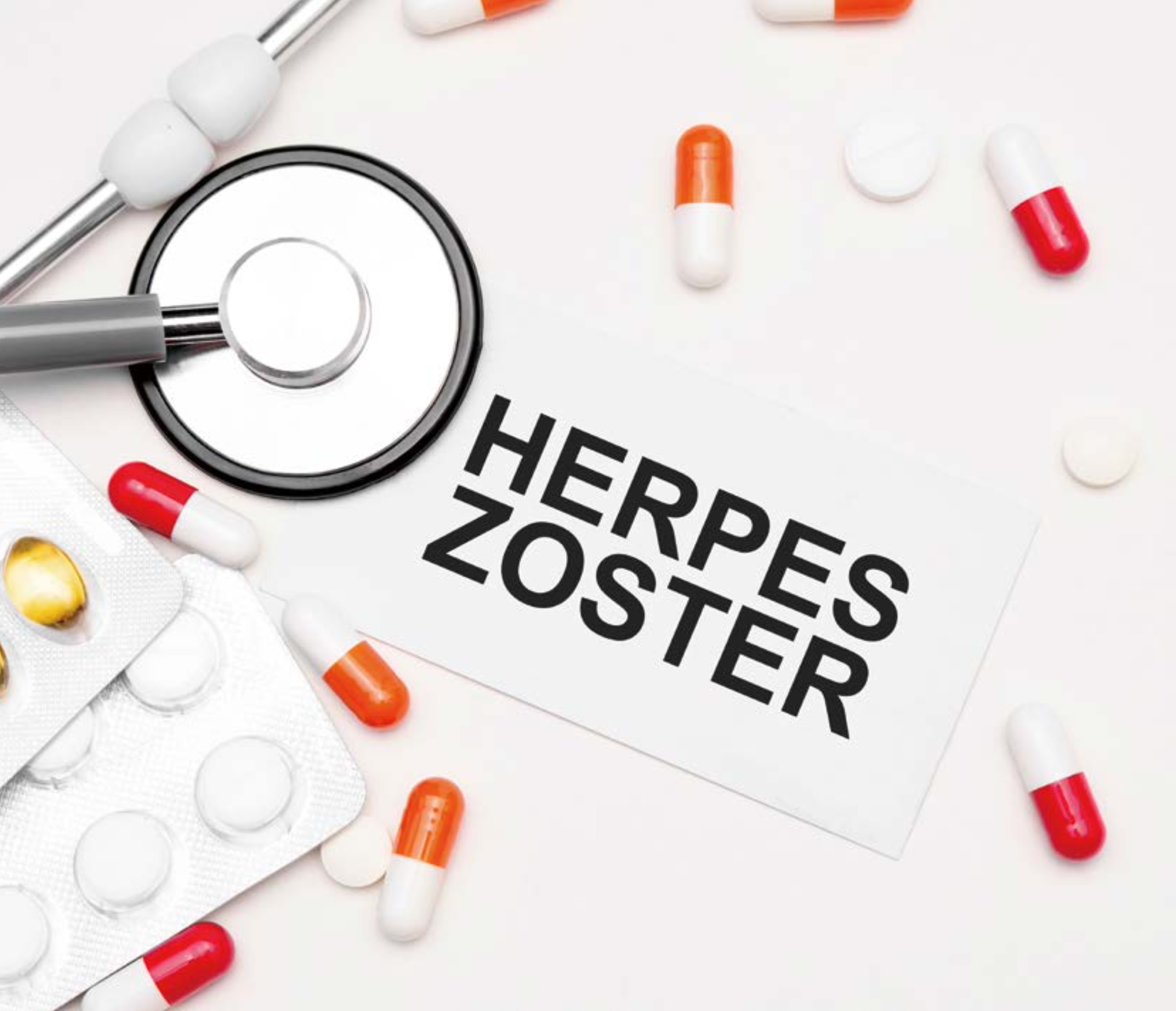 청진기와 다양한 알약들 사이에 'HERPES ZOSTER(대상포진)'라고 적힌 카드가 놓여 있는 의료 관련 이미지입니다.