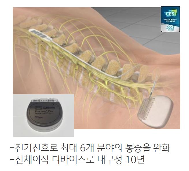 'Abbott'에선 '신체이식' '통증완화' 기기를 만들어 냄.