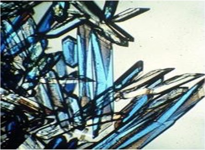 '국제우주정거장(ISS)의 미세 중력 환경에서 성장한 단백질 결정'입니다. 중력의 방해 없이 자라나 결정의 크기가 훨씬 크고, 투명도가 높으며 규칙적인 결정 격자 구조를 보여줍니다.