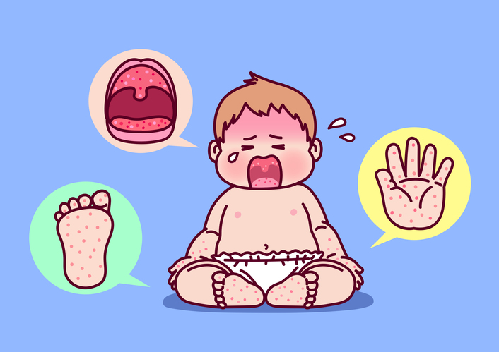 손, 발, 입에 수족구 증상을 보이는 아이가 앉아서 울고 있다. 